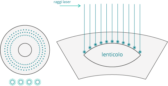 Altri metodi